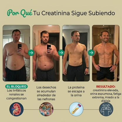 Nueva fórmula de máxima potencia: Cápsulas de drenaje linfático renal de Sculptique™